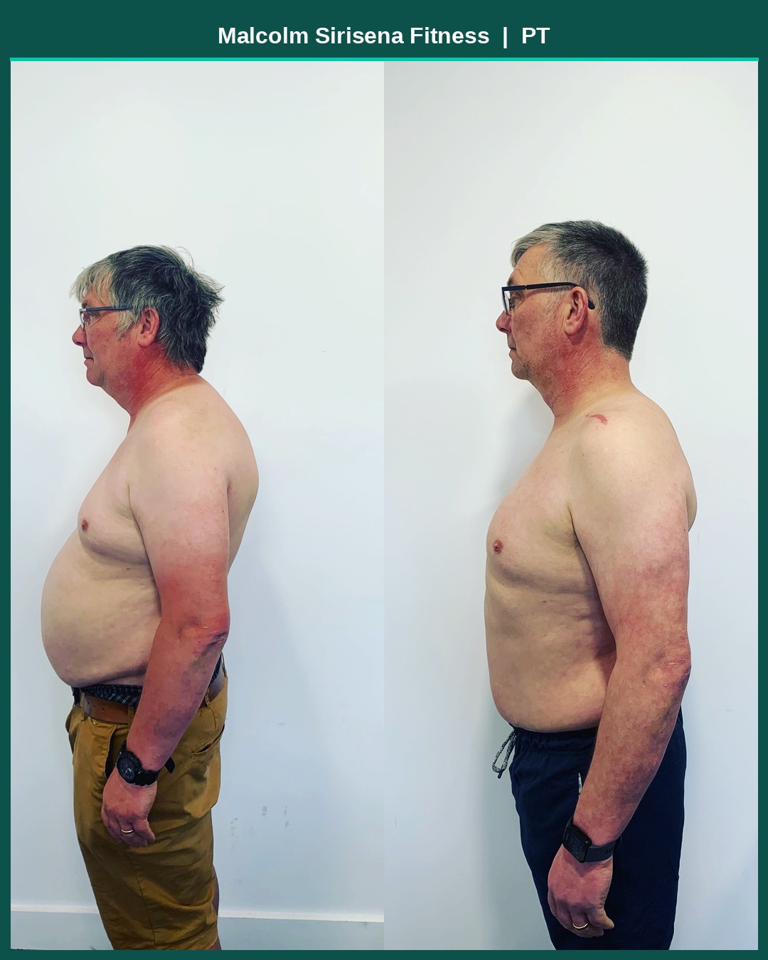 Client before and after transformation, side view